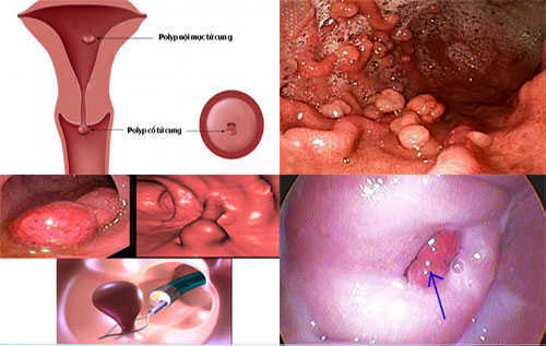 4. Phương pháp chẩn đoán và điều trị