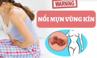 nhin-hinh-anh-noi-mun-vung-kin-nu-doan-benh-90-chi-em-dang-hieu-sai-dieu-nay