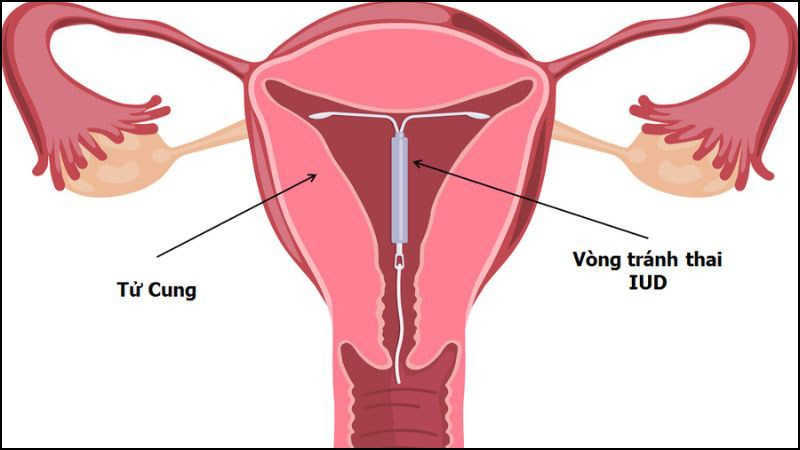 dat vong tranh thai