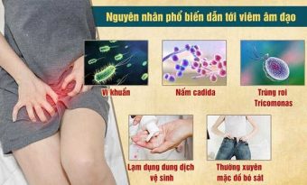 phuong-phap-dieu-tri-viem-am-dao-hieu-qua-lau-dai