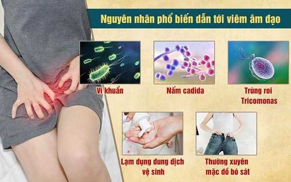 Nguyên nhân viêm âm đạo