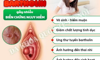 chich-ap-xe-tuyen-bartholin