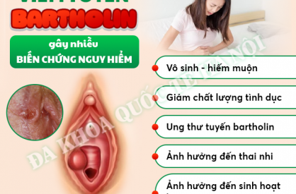 chich-ap-xe-tuyen-bartholin