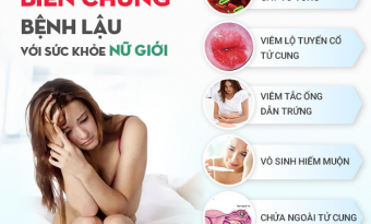 tieu-buot-tieu-ra-mu