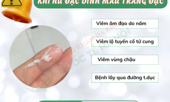 khi-hu-dac-dinh-mau-trang-duc