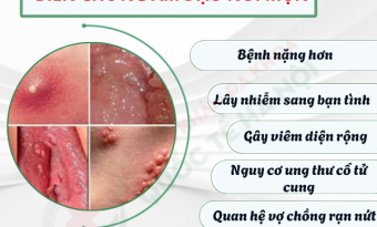 am-dao-noi-mun-bieu-hien-cua-benh-ly-sinh-duc